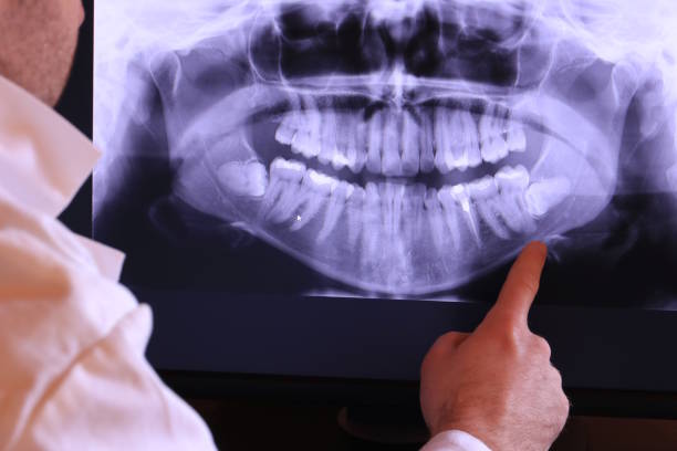 Best Broken or Cracked Tooth Emergency Dentist in Broad Brook, CT