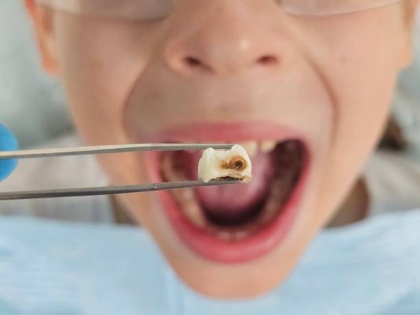 Best Emergency Dental Services for Seniors in Broad Brook, CT